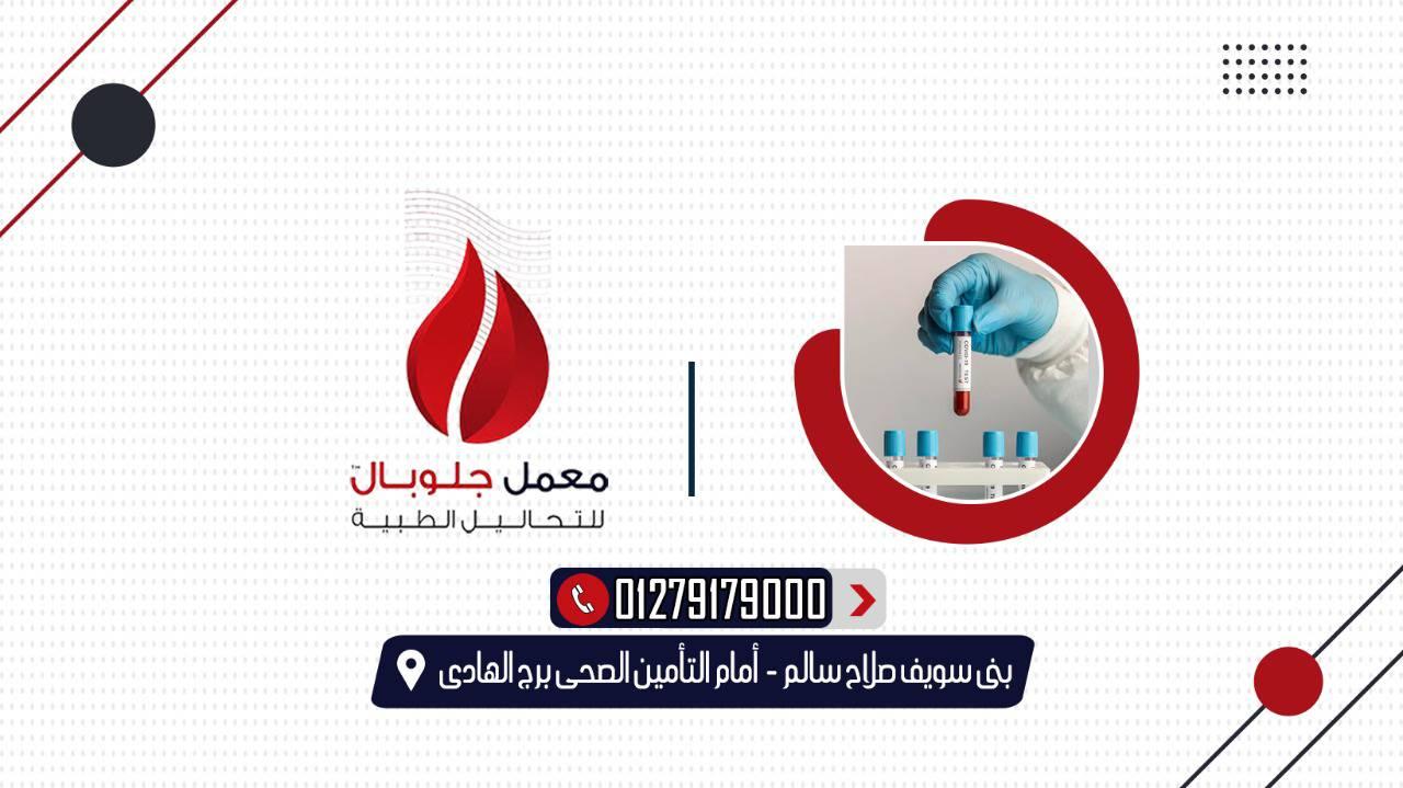 معمل جلوبال