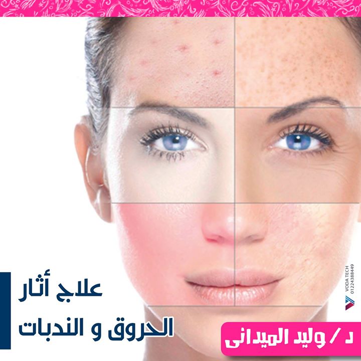Dr. Walid Al Maidani for Cosmetic Surgery and Laser